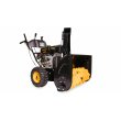 Снегоотбрасыватель Champion ST1170E 